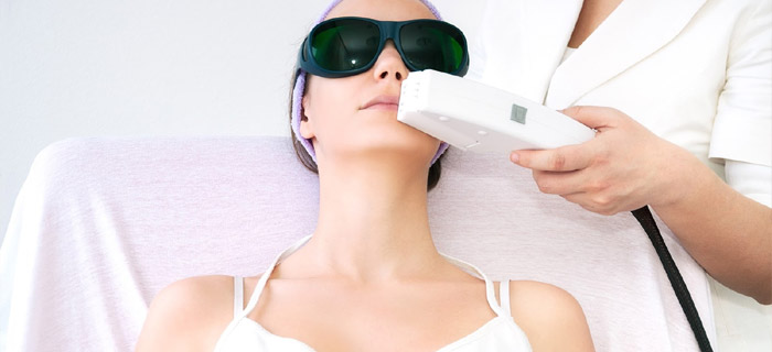 permanent laser hair removal
